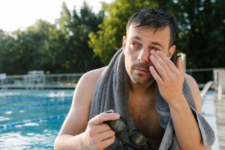 Occhi rossi dopo piscina: cloro, lenti e schermi da distinguere